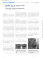 Subkutaner Tumor des oberen Augenlides: Befall durch Dirofilaria repens