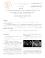 A Case Report of Perineural Cysts, Also Known as Tarlov Cysts