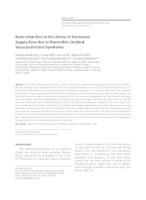 Brain Infarction in the Artery of Percheron Supply Area due to Reversible Cerebral Vasoconstriction Syndrome