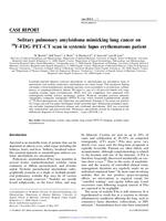 Solitary pulmonary amyloidoma mimicking lung cancer on 18 F-FDG PET-CT scan in systemic lupus erythematosus patient
                  