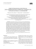 prikaz prve stranice dokumenta Rare Intracranial Multifocal Non-Germinomatous Germ Cell Tumor in an 18-Year-Old Male: A Case Report